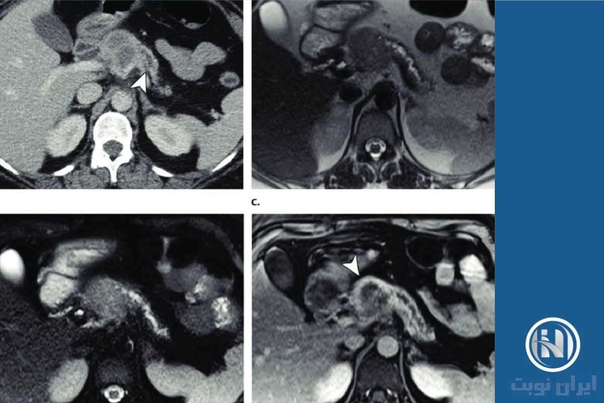 مراقبت‌های بعد از انجام MRI