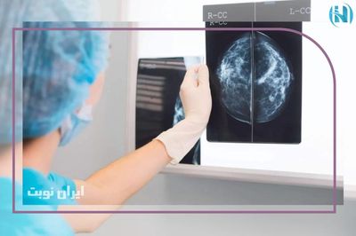 فوکال آسیمتری در ماموگرافی 