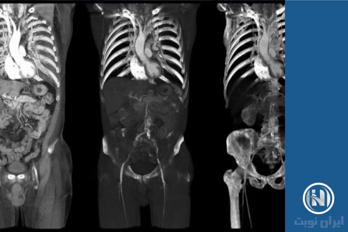 کاربردهای سی تی اسکن Abdomen and pelvic