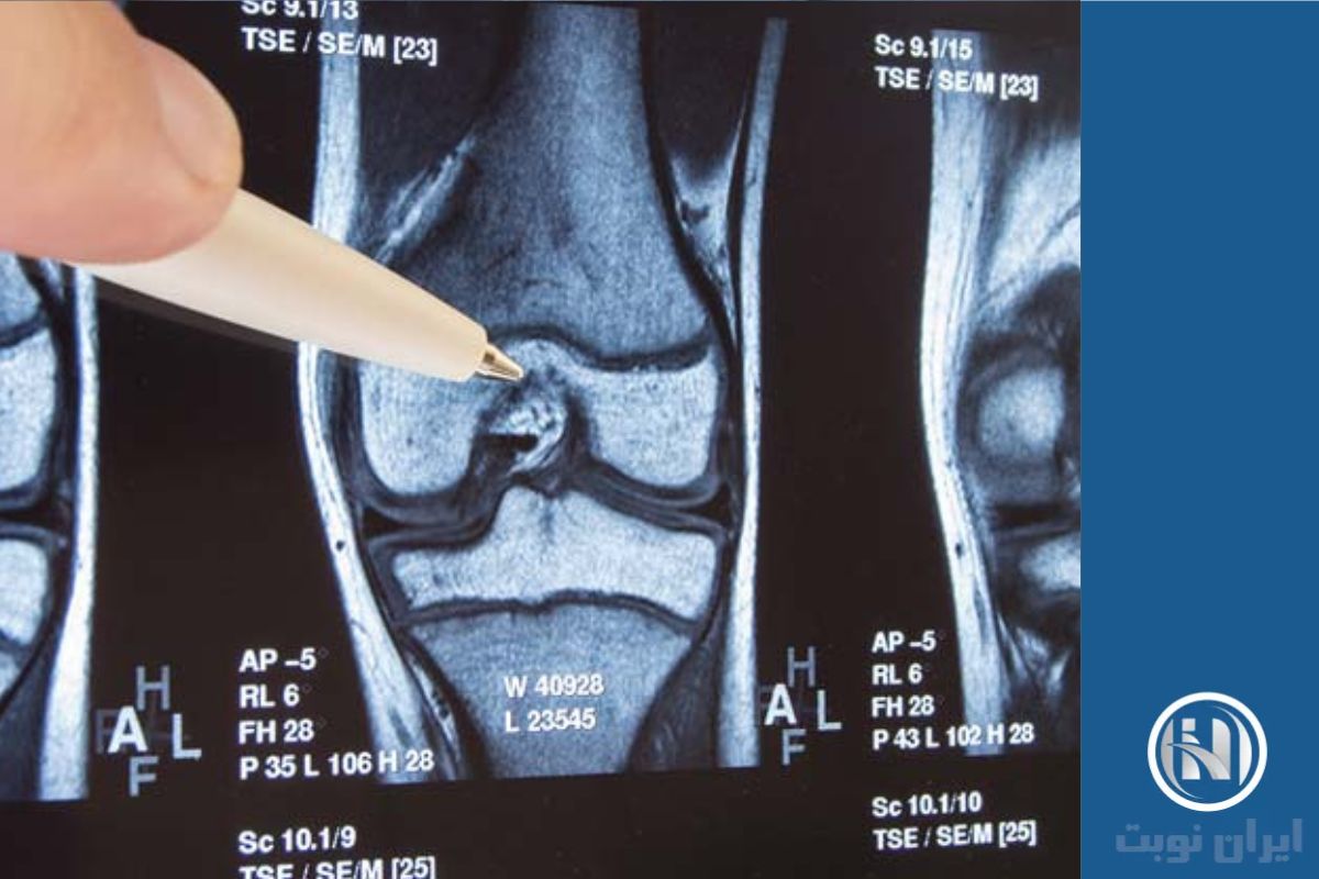 اصطلاحات تخصصی knee MRI 