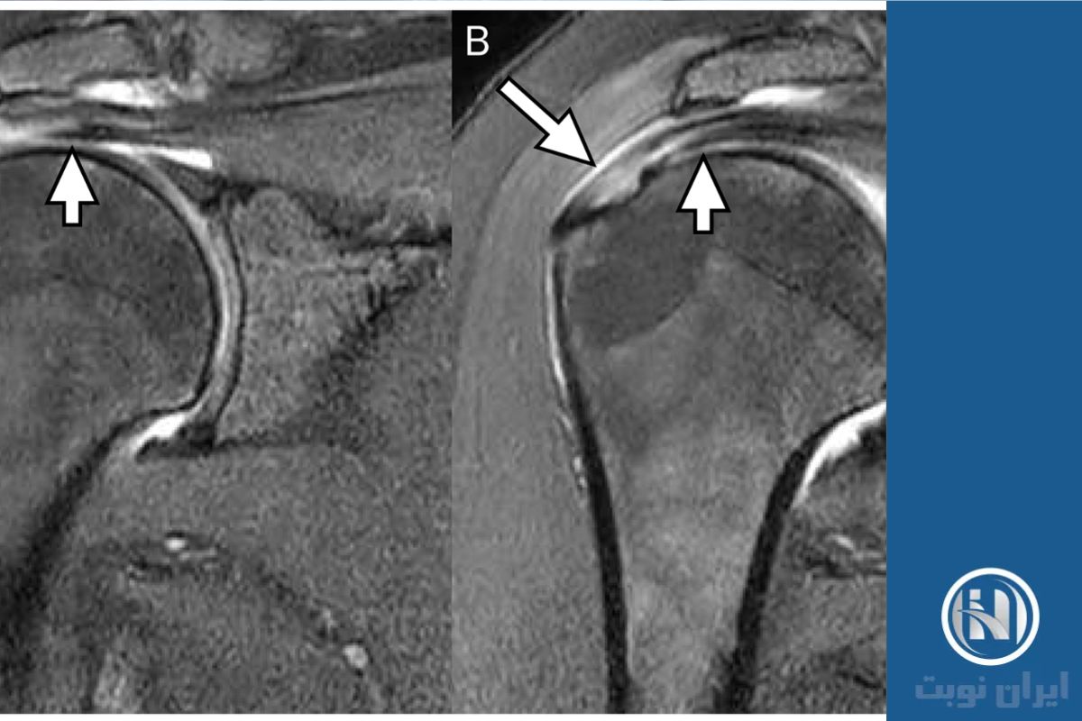 فرآیند انجام MRI 