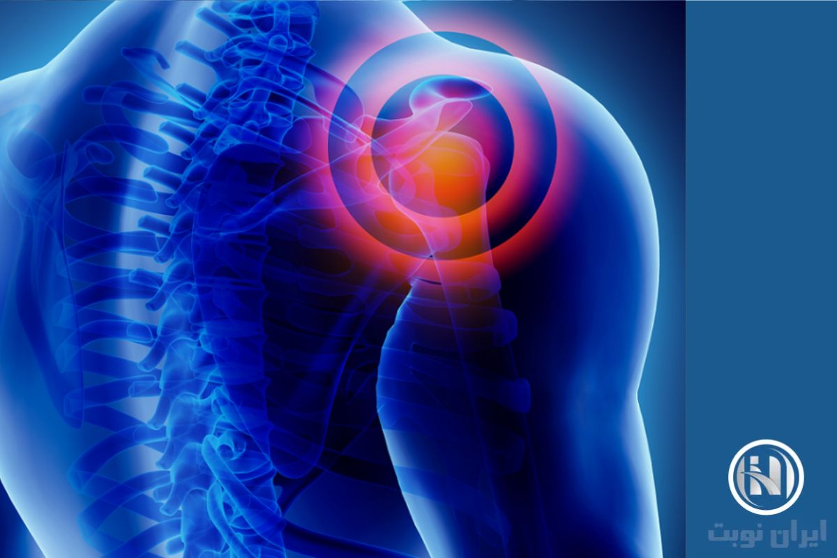 اصطلاحات تخصصی جواب shoulder MRI