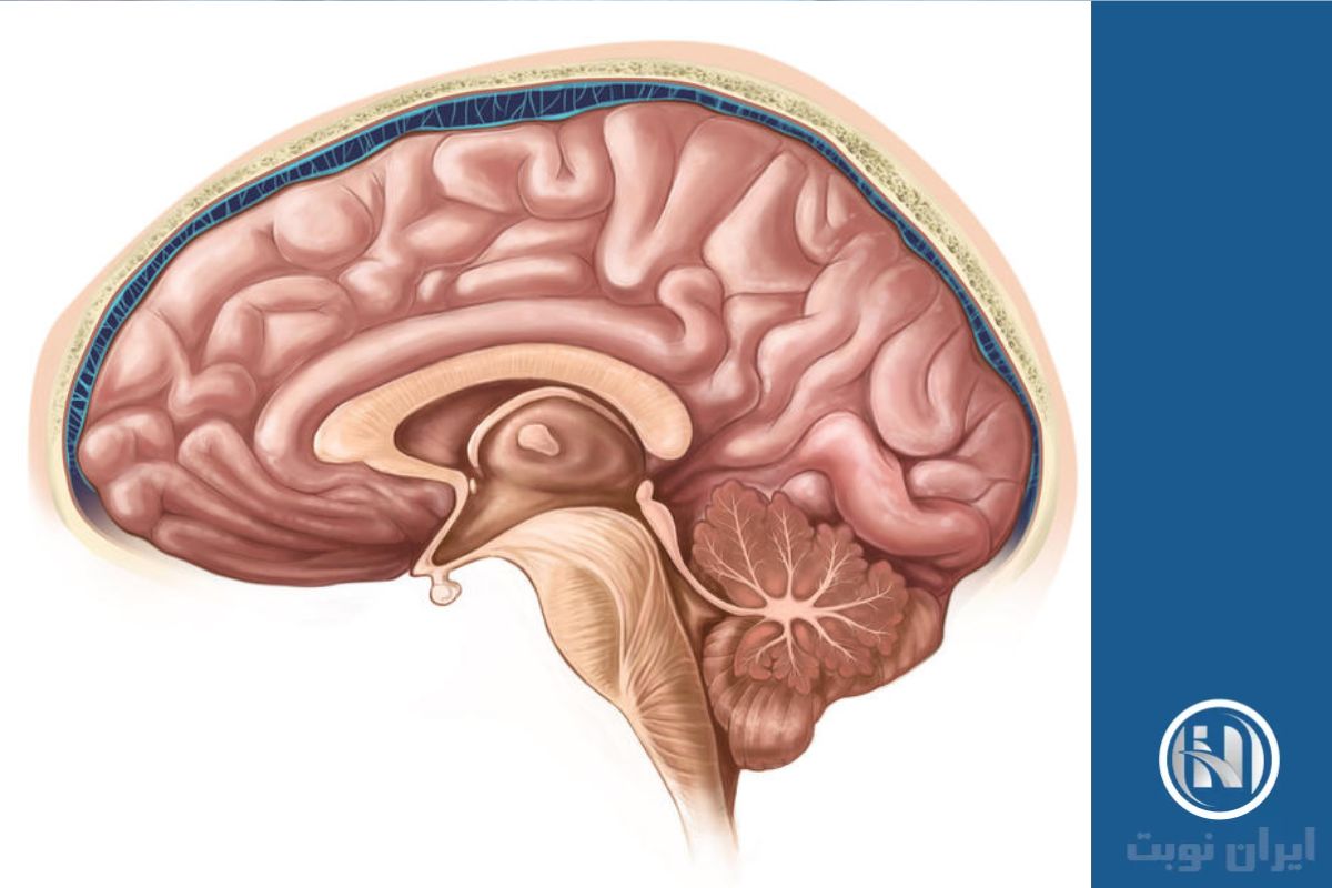 مزایای استفاده از brain MRI