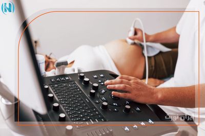گزارش سونوگرافی بیوفیزیکال جنین